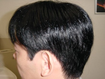 男性かつら・装着後